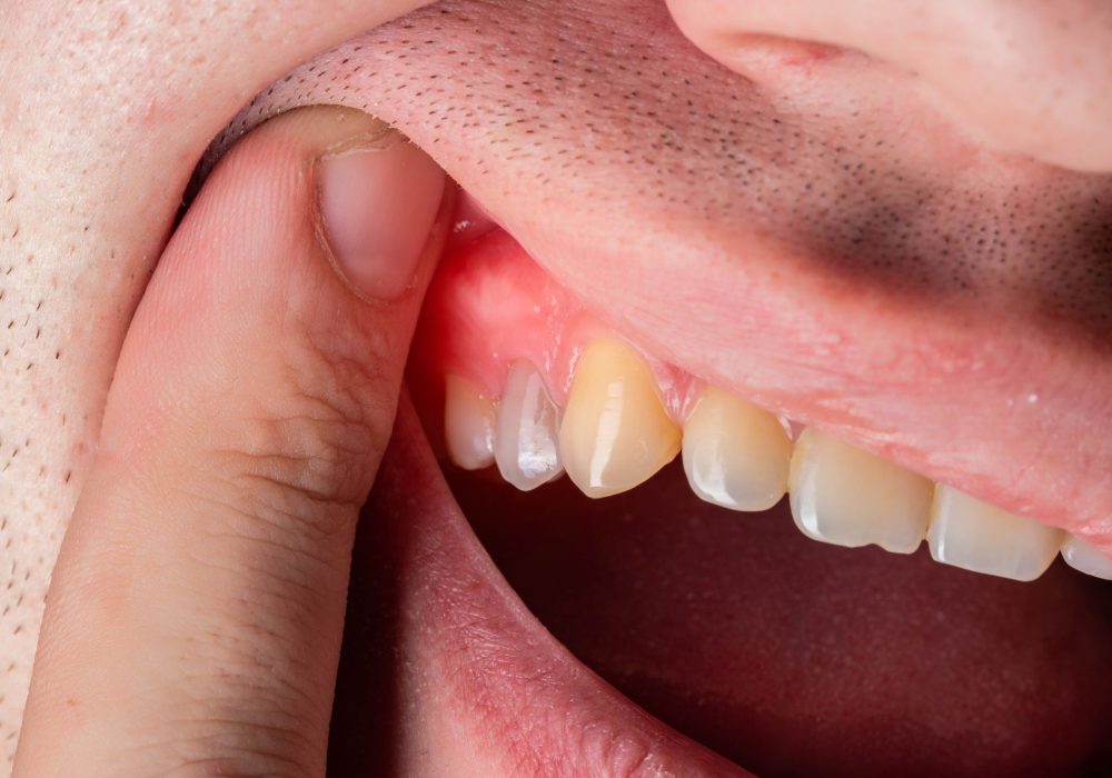 periodontia periodontia